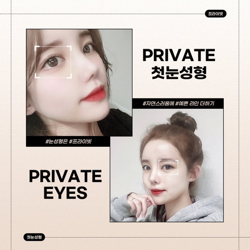 First Eye Surgery at Sinsa Station Private Plastic Surgery Clinic 사진 6