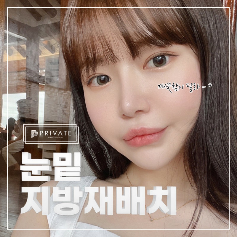 รีวิวดีๆ หลังทำศัลยกรรมใต้ตา ที่ Private Plastic Surgery คลินิกศัลยกรรมชินซา 사진 2