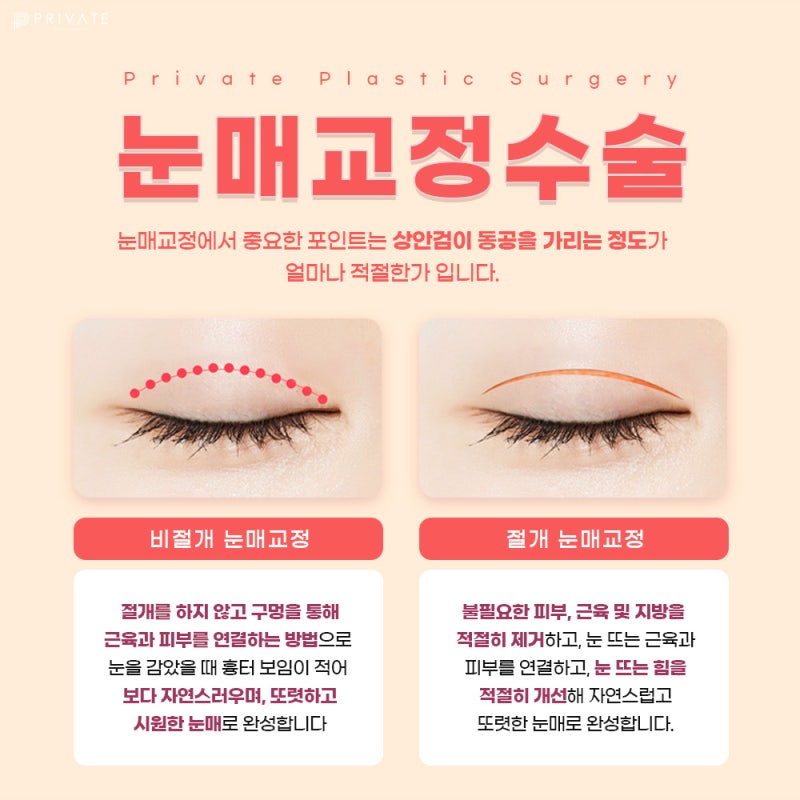 Ptosis Correction Surgery at Private Plastic Surgery Clinic 사진 5