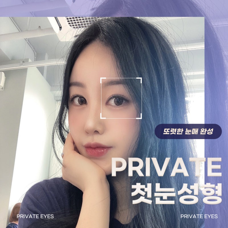 Sinsa Private Plastic Surgery: A Great Place for Double Eyelid Surgery 사진 2