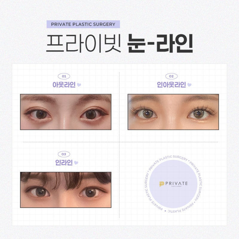 目の再手術が上手なのは新沙プライベート整形外科 사진 4
