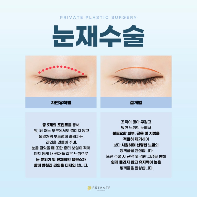 รีวิวศัลยกรรมแก้ไขตาสองชั้นแบบธรรมชาติที่ดีที่สุดที่ Private Plastic Surgery 사진 4