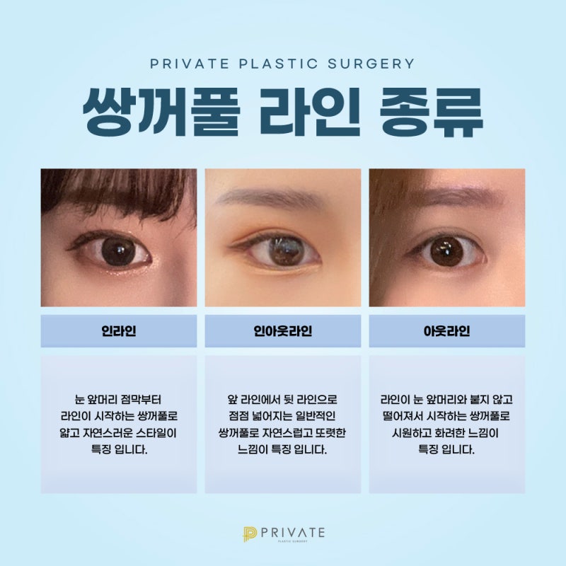 รีวิวศัลยกรรมแก้ไขตาสองชั้นแบบธรรมชาติที่ดีที่สุดที่ Private Plastic Surgery 사진 5