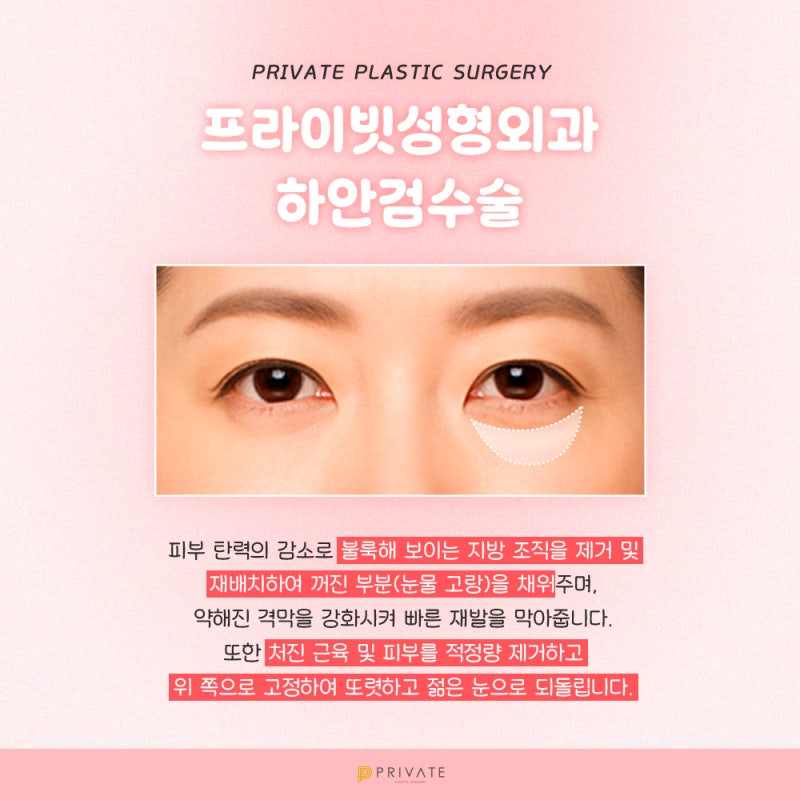 Sinsa Private Plastic Surgery Clinic: Lower Blepharoplasty Reviews
