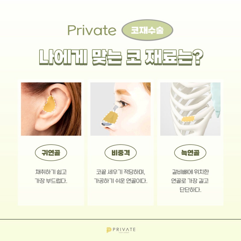 Ulasan Rumah Sakit Bedah Revisi Hidung, Cek di Private 사진 4