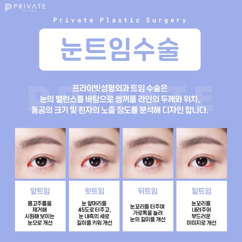 Private Plastic Surgery Clinic Excels in Canthoplasty