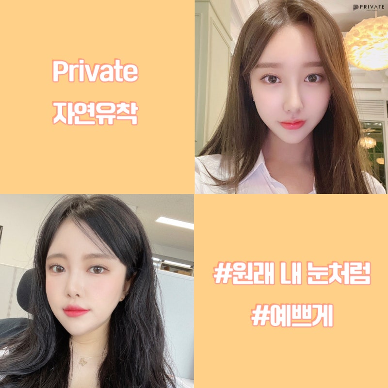 รีวิวศัลยกรรมตาสองชั้นแบบธรรมชาติที่ Private Plastic Surgery 사진 6