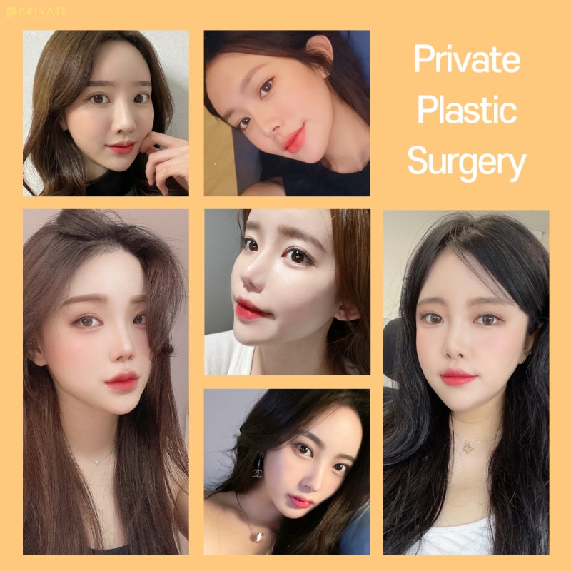 รีวิวศัลยกรรมตาสองชั้นแบบธรรมชาติที่ Private Plastic Surgery 사진 7