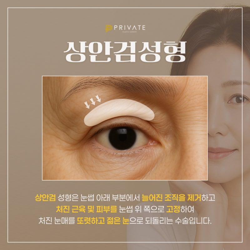 Check Upper Blepharoplasty Reviews at Private Plastic Surgery