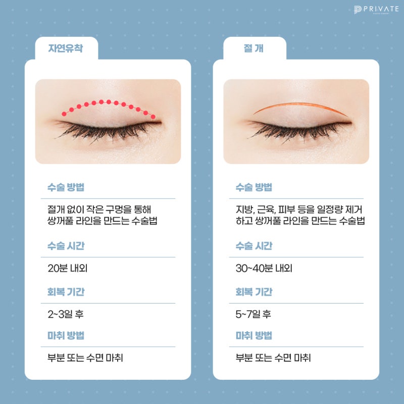 Private Plastic Surgery Clinic: Expert Double Eyelid Surgery 사진 5