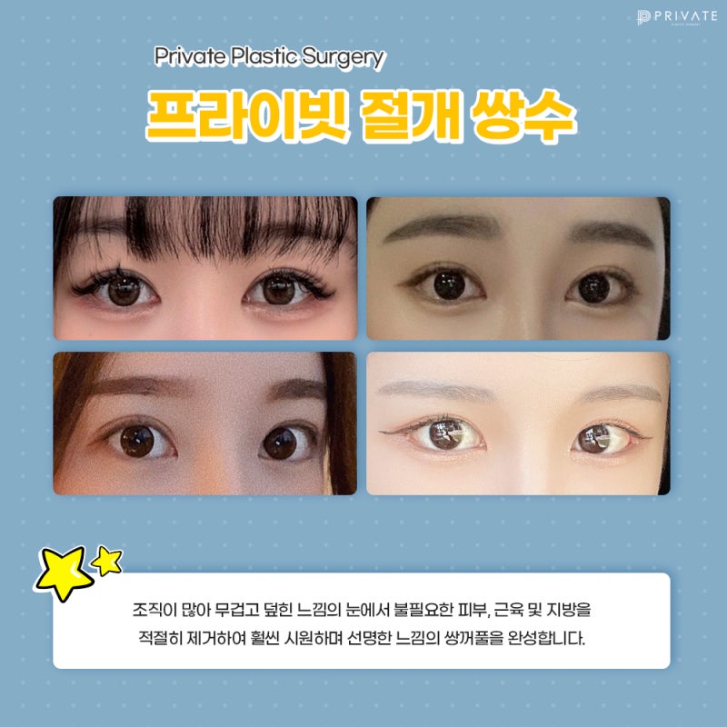 Private Plastic Surgery Clinic: Expert Double Eyelid Surgery 사진 4
