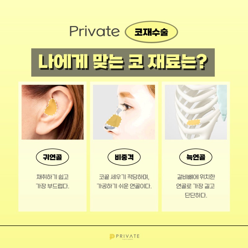 Ulasan Operasi Revisi Hidung di Private Plastic Surgery