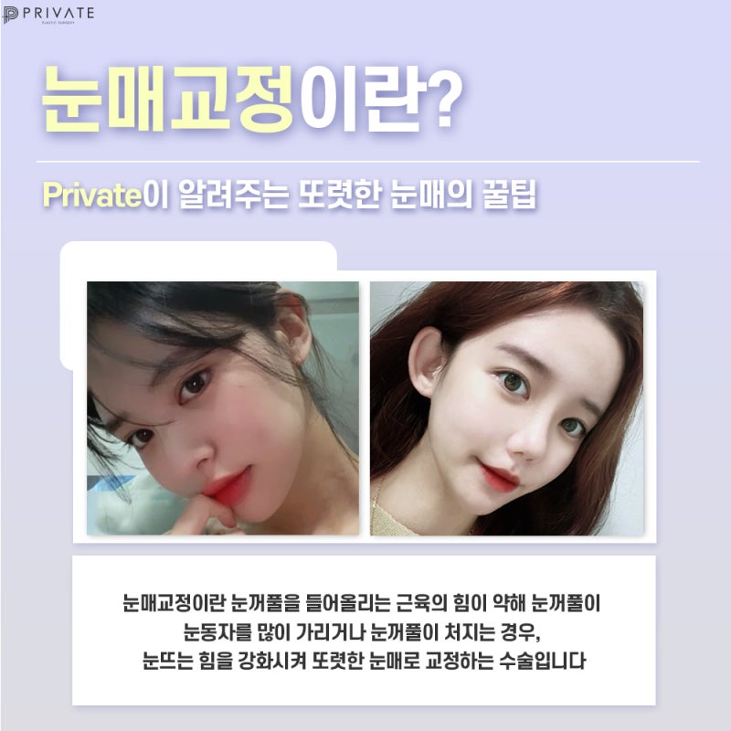 Before and After Ptosis Correction Surgery at Private Plastic Surgery Clinic