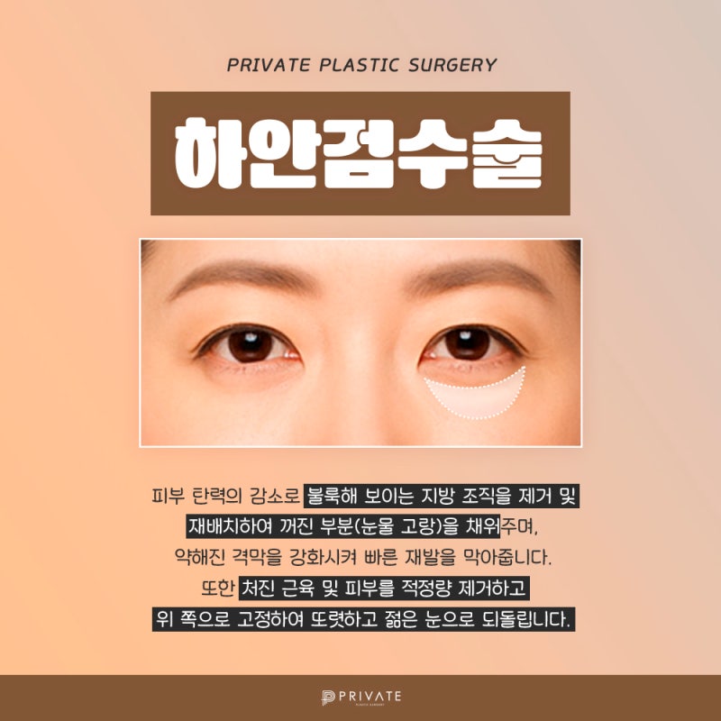 Lower Blepharoplasty at Sinsa Private Plastic Surgery Clinic