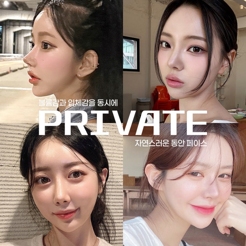 รีวิวการผ่าตัดจัดเรียงไขมันใต้ตาที่ Private Plastic Surgery 사진 6