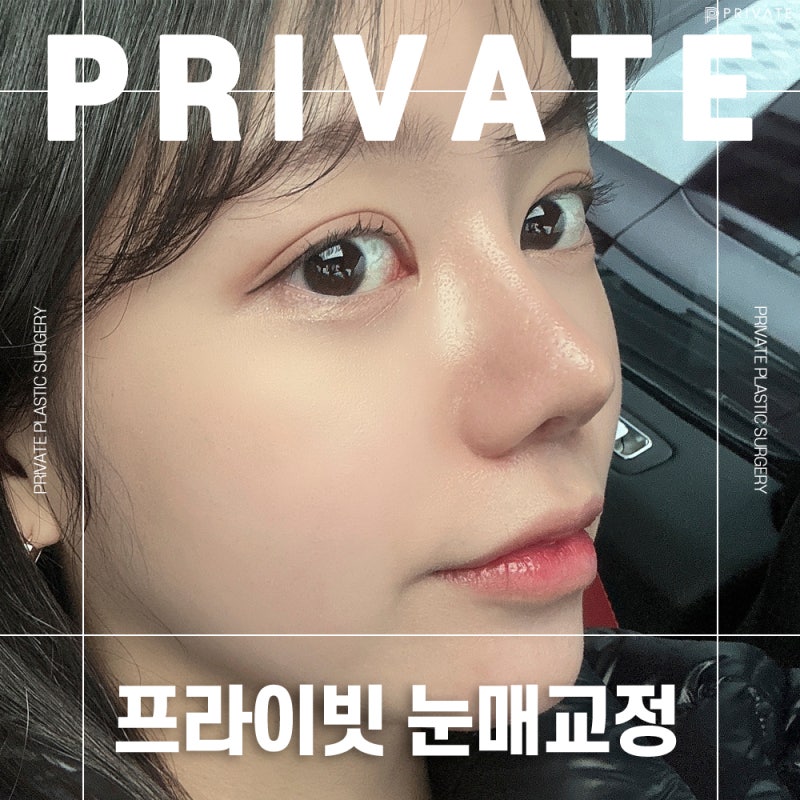 Private Plastic Surgery Clinic with Excellent Ptosis Correction Results 사진 2