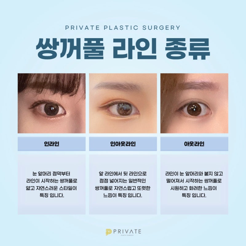 Sinsa Private Plastic Surgery: Expert Eye Revision Surgery 사진 5