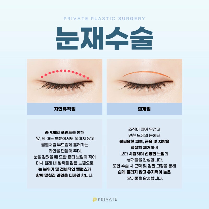 Sinsa Private Plastic Surgery: Expert Eye Revision Surgery 사진 4
