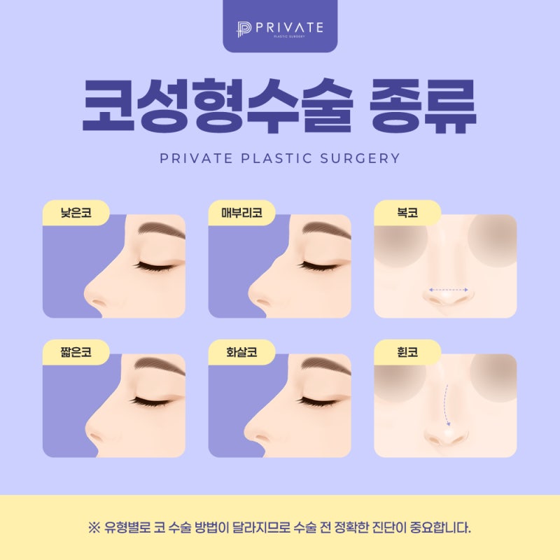 Private Plastic Surgery Clinic: Good Reviews for Nose Surgery 사진 4