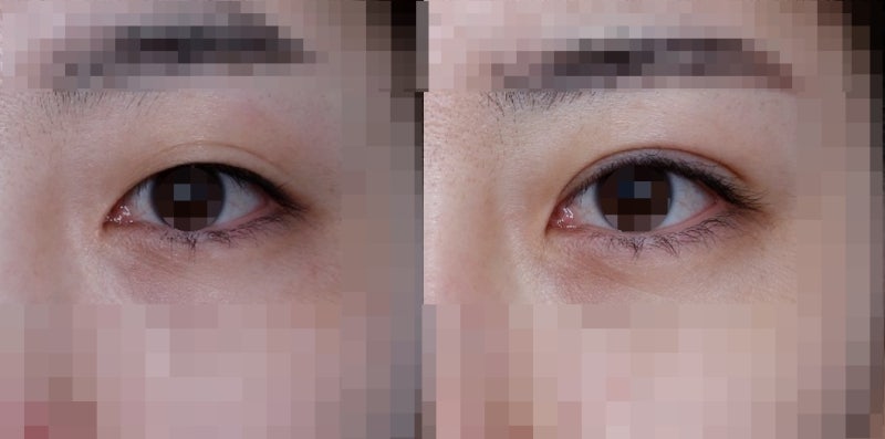 About ‘Big Eyes’ and ‘Clear Eyes’ 사진 2