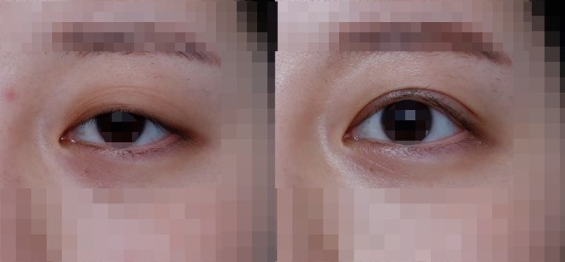 About ‘Big Eyes’ and ‘Clear Eyes’ 사진 3