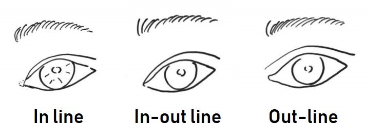 Types of Double Eyelid Lines (In-line, In-out line, Out-line)