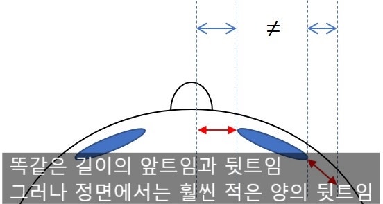 About Lateral Canthoplasty and Lower Canthoplasty 사진 3
