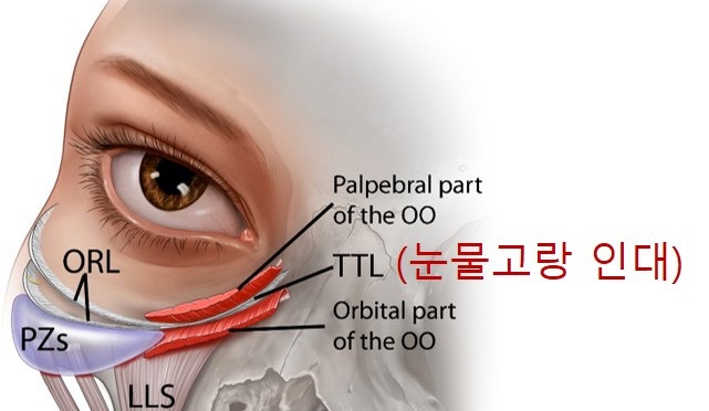 <Lower Blepharoplasty Part 1> Regarding Lower Eyelid Fillers? Fat Grafting?
