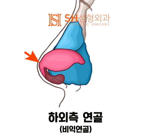 #14 Rhinoplasty, Tip Plasty Materials: Understanding Nasal Structure First 사진 4