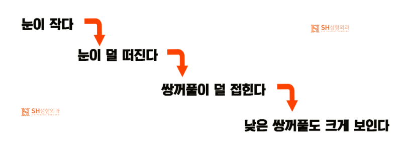 #17 How to Correct Asymmetrical Eyes Without Ptosis Correction — Symmetrical Design by Facial Designer Dr. Kim Sung-hoon