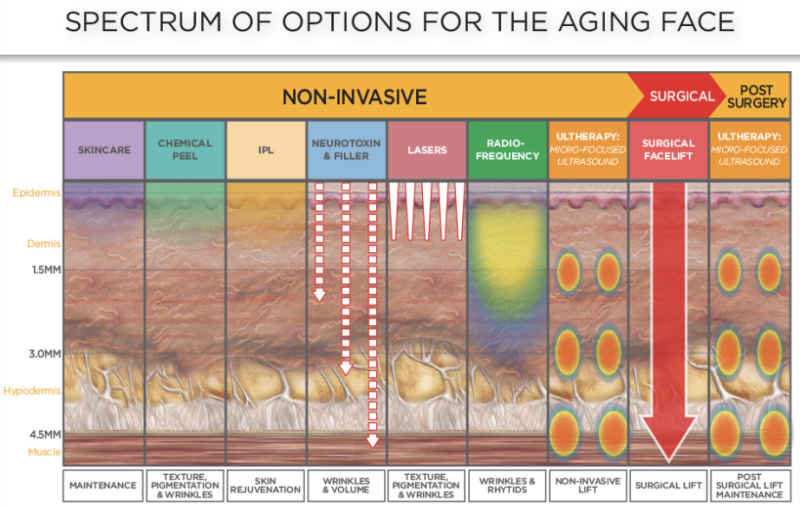 #23 Ultherapy vs. Oligio – 'Lifting devices truly make a difference when you know them well.' 사진 5