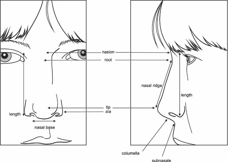 #29 Alar Reduction vs. Long Nose Surgery, How to Decide on Tip Plasty? _ Tip Plasty Review, Recovery at SH Plastic Surge