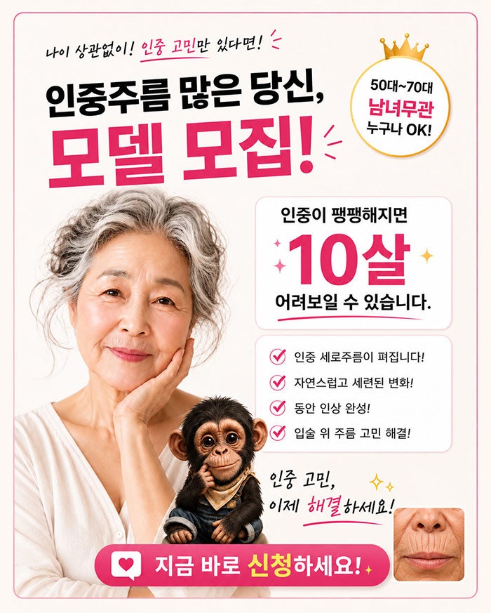 How to Get Rid of Vertical Philtrum Wrinkles! SH Plastic Surgery is Recruiting Models~ Click Here if You're Concerned Ab