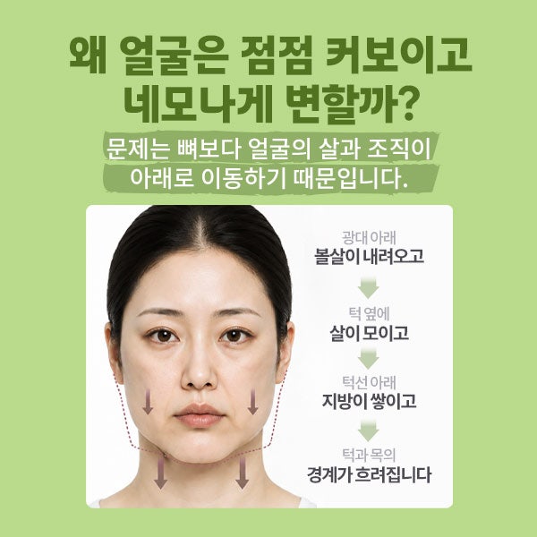 Renuvion Face Lift (SH) SH Plastic Surgery Clinic Informs About Non-Incisional Facelift~ 사진 7