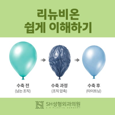 Renuvion Face Lifting (sh) SH Plastic Surgery Memberitahukan Facelift Non-Invasif~ 사진 6