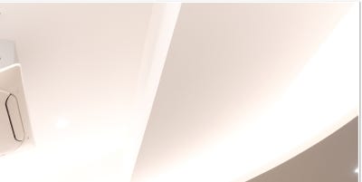 부산 연산동 귀필러 요정귀 시술 인기인 이유는? 사진 14
