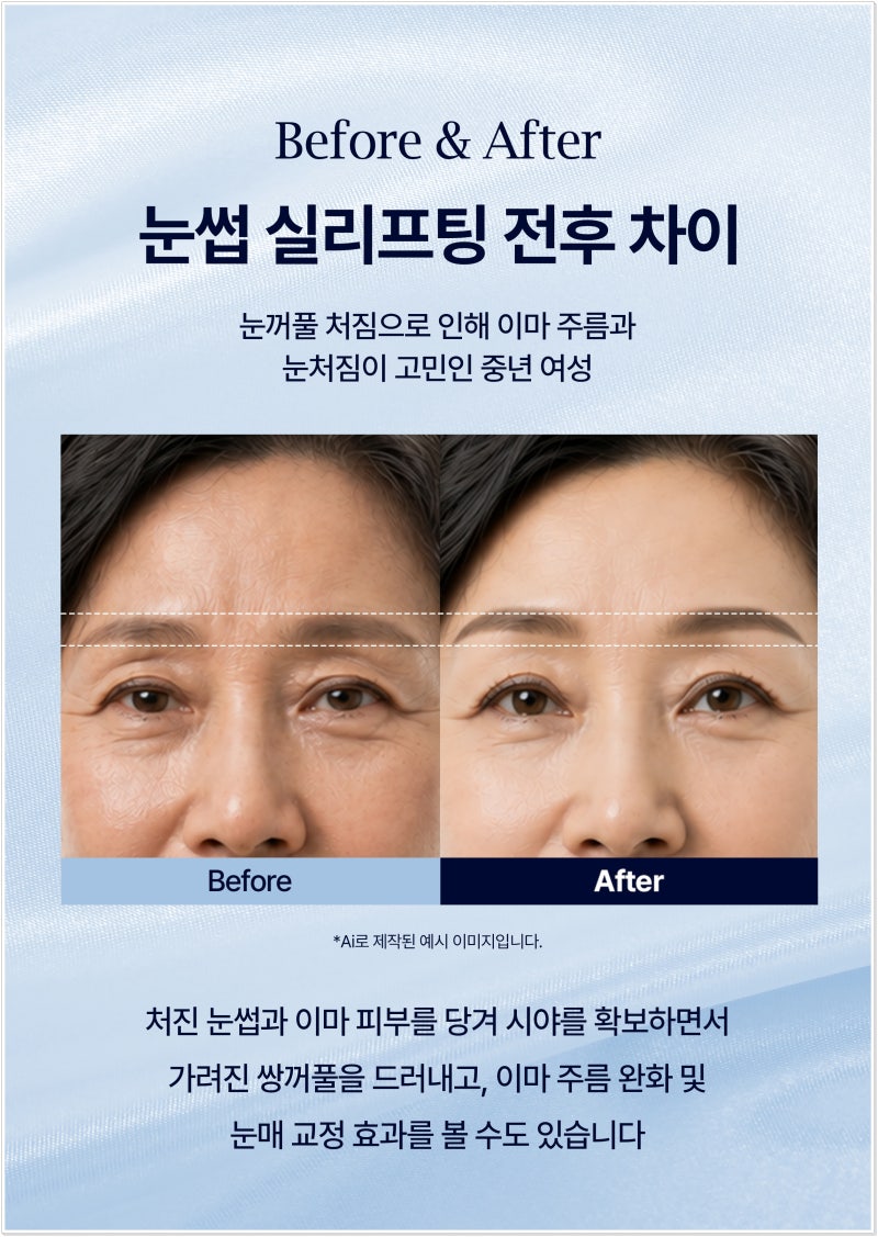 연산동 눈썹 실리프팅, 처진 눈매가 고민이라면 확인해야 할 핵심 포인트 사진 4
