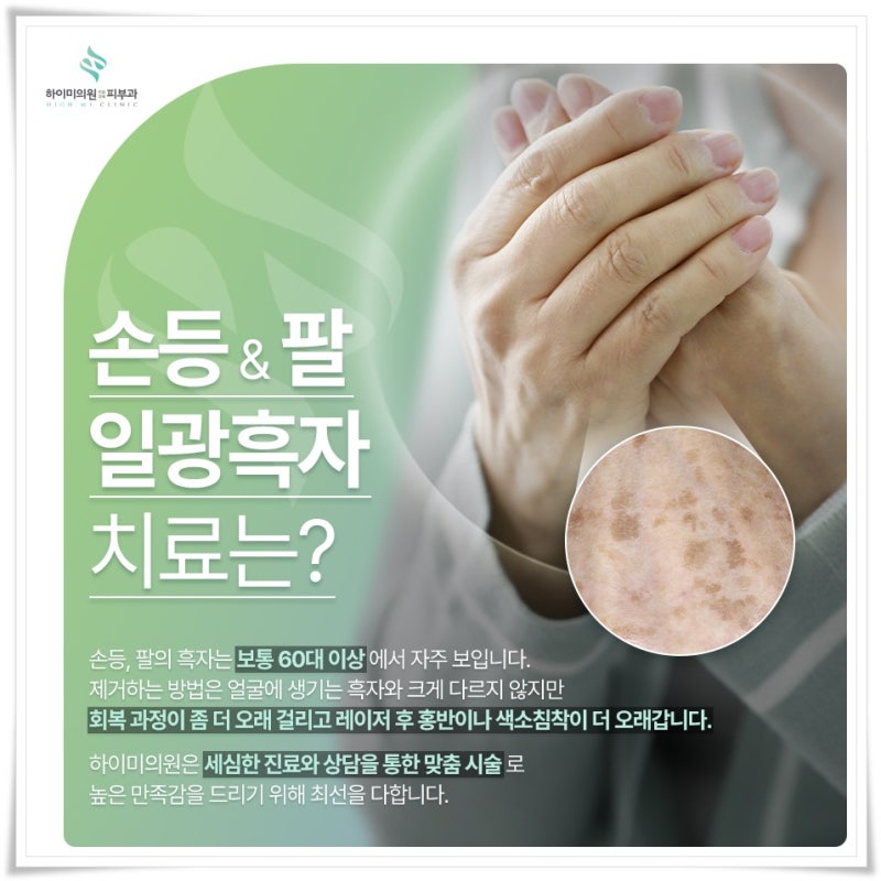연산역검버섯 단순한 잡티로 넘기지 말아야 하는 이유 사진 8