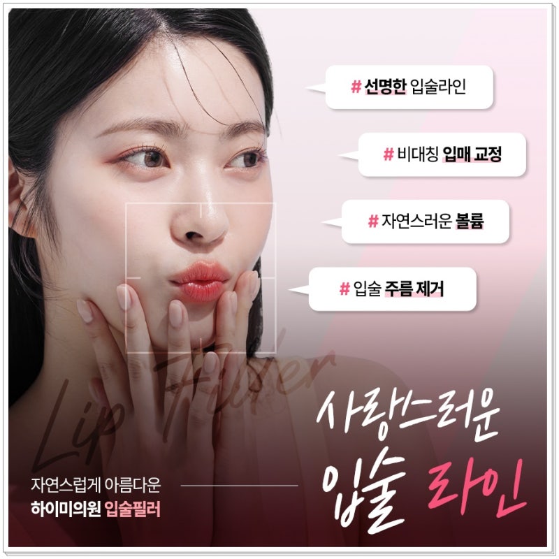 연산역피부과의원 입술필러, 자연스러운 입매를 원한다면 확인해야 할 기준 사진 2