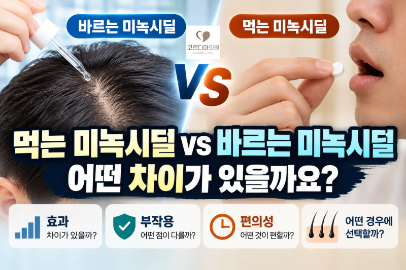 Minoxidil Minum vs Minoxidil Oles, Apa Saja Perbedaannya? | Klinik Perawatan Rambut Rontok Seolleung
