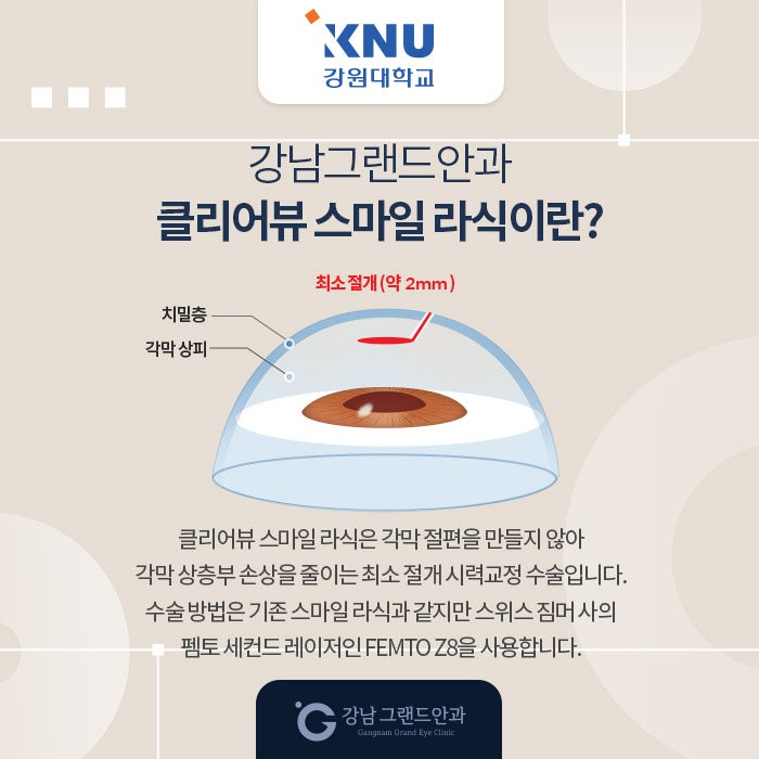 강원대학교 시력교정 제휴 혜택 안내 사진 3