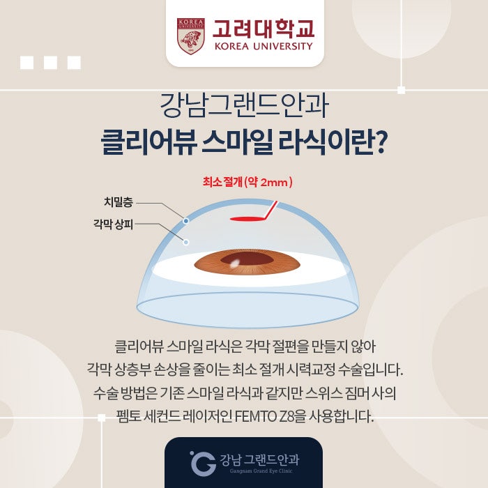 고려대학교 시력교정 제휴 혜택 안내 사진 3