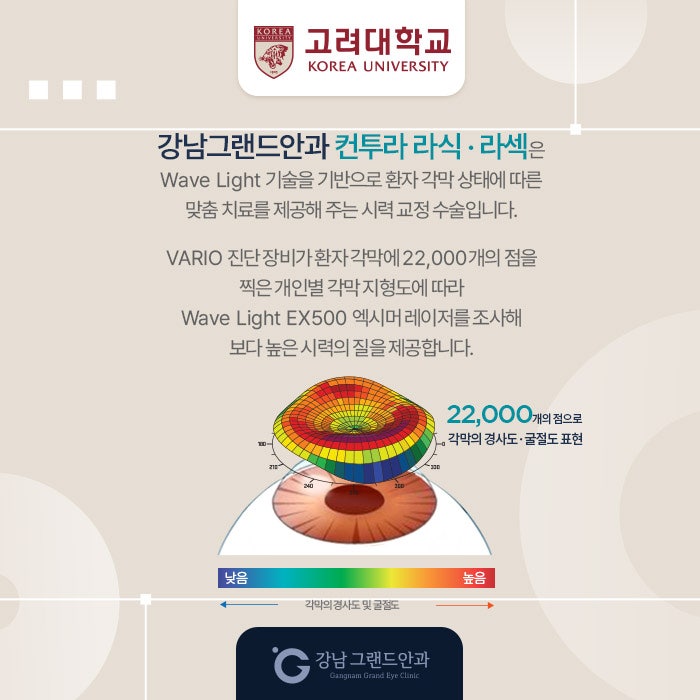 고려대학교 시력교정 제휴 혜택 안내 사진 6