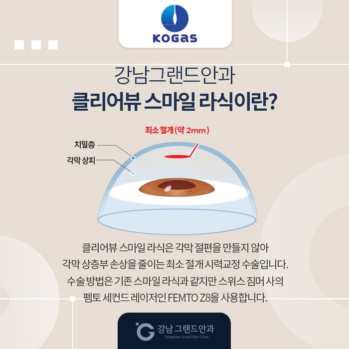 한국가스공사 임직원 시력교정 제휴 혜택 안내 사진 3