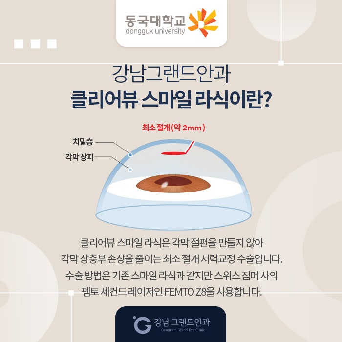 동국대학교 시력교정 제휴 혜택 안내 사진 3