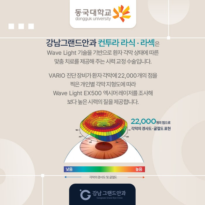 동국대학교 시력교정 제휴 혜택 안내 사진 6