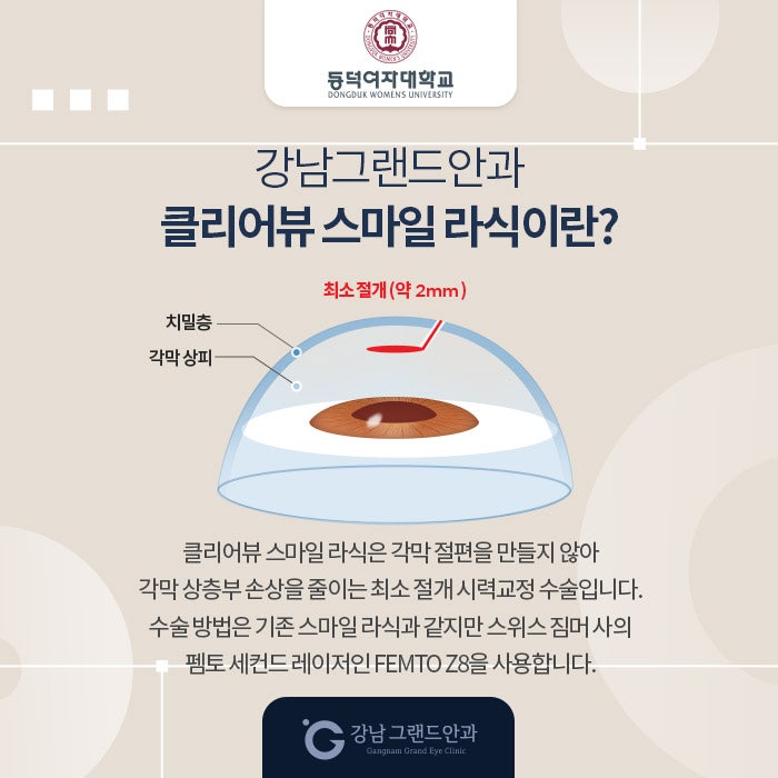 동덕여자대학교 시력교정 제휴 혜택 안내 사진 3