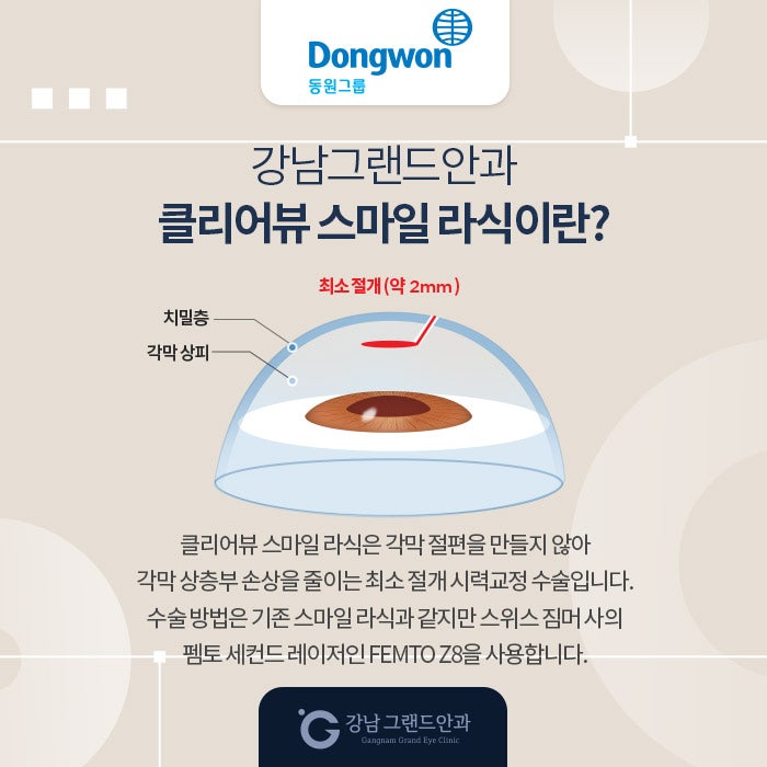동원그룹 임직원 시력교정 제휴 혜택 사진 3