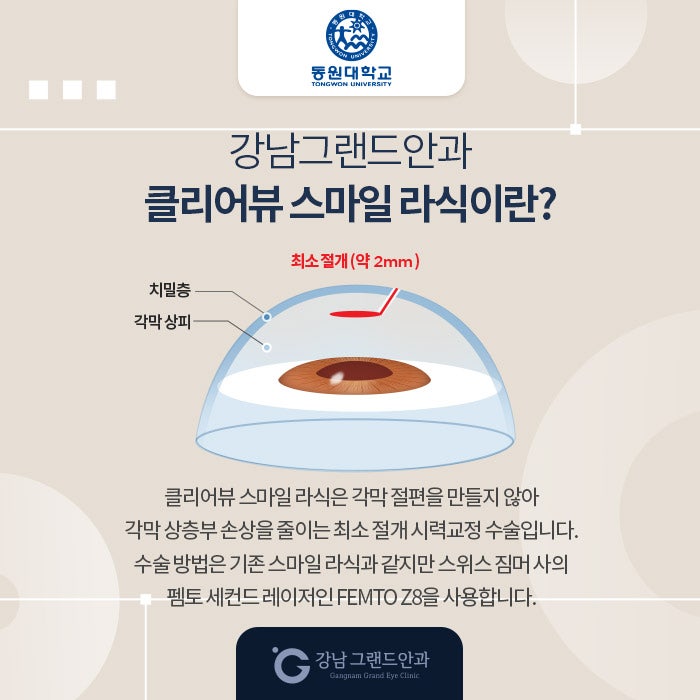 동원대학교 시력교정 제휴 혜택 안내 사진 3