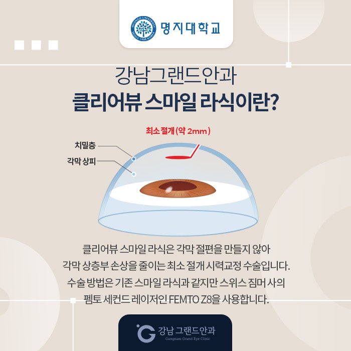명지대학교 시력교정 제휴 혜택 안내 사진 3